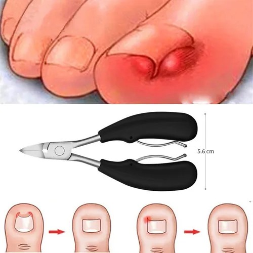 Corta uñas dedo pie gruesas encarnadas